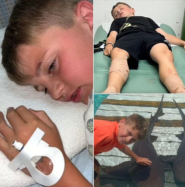 A Terrifying Experience: Young Boy Attacked by Sharks During Family Vacation